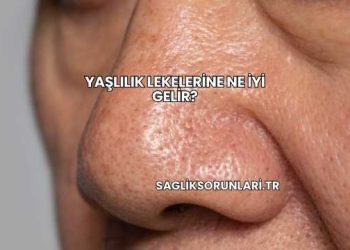 Yaşlılık Lekelerine Ne İyi Gelir?