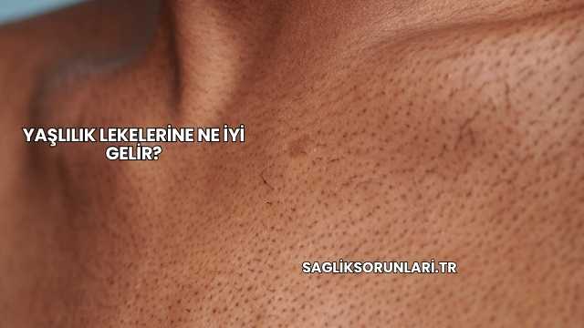 Yaşlılık Lekelerine Ne İyi Gelir?