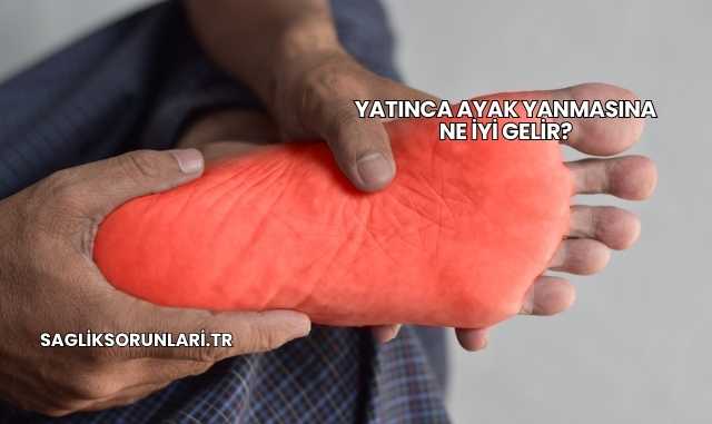 Yatınca Ayak Yanmasına Ne İyi Gelir?