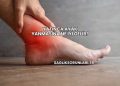 Yatınca Ayak Yanmasına Ne İyi Gelir?