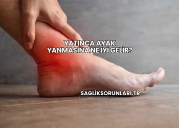 Yatınca Ayak Yanmasına Ne İyi Gelir?