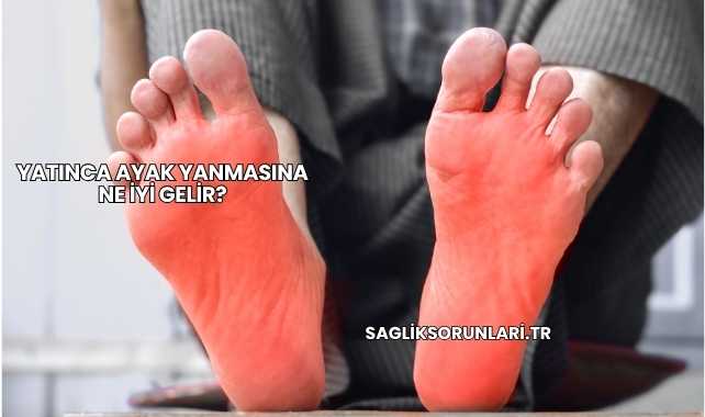 Yatınca Ayak Yanmasına Ne İyi Gelir?