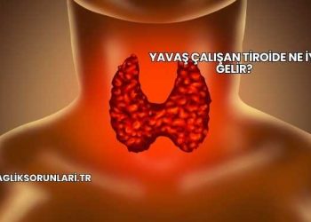 Yavaş Çalışan Tiroide Ne İyi Gelir?