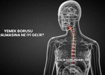 Yemek Borusu Daralmasına Ne İyi Gelir?