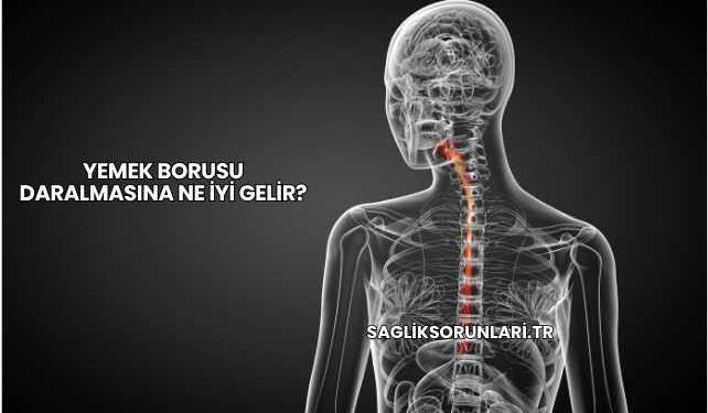 Yemek Borusu Daralmasına Ne İyi Gelir?