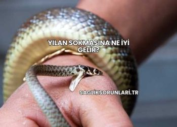 Yılan Sokmasına Ne İyi Gelir?
