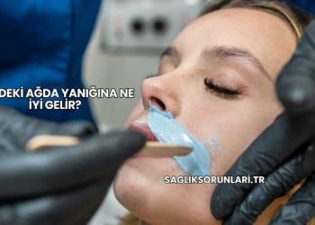 Yüzdeki Ağda Yanığına Ne İyi Gelir?