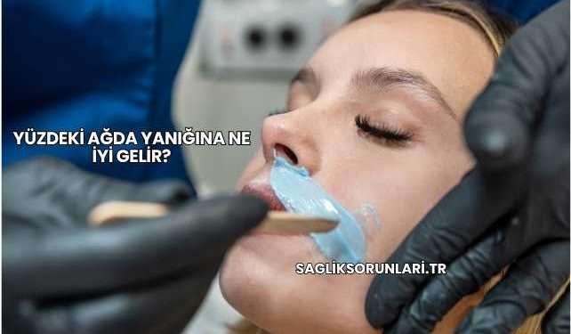Yüzdeki Ağda Yanığına Ne İyi Gelir?