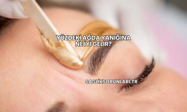 Yüzdeki Ağda Yanığına Ne İyi Gelir?