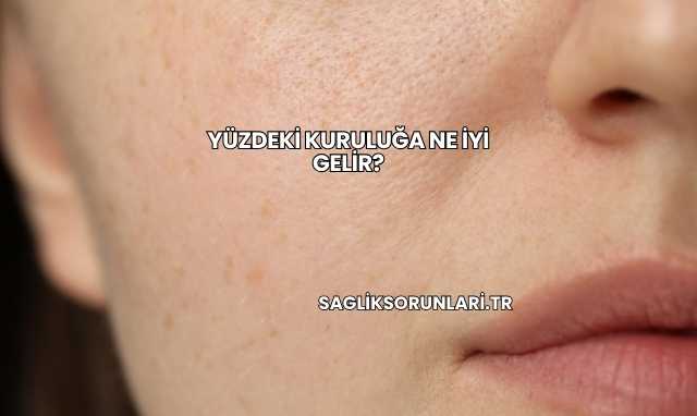 Yüzdeki Kuruluğa Ne İyi Gelir?