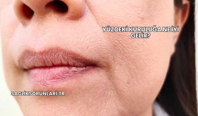 Yüzdeki Kuruluğa Ne İyi Gelir?