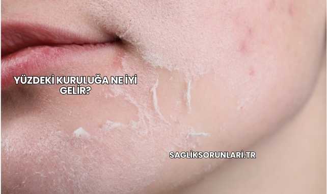 Yüzdeki Kuruluğa Ne İyi Gelir?