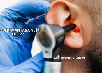 Yüzdeki Mantara Ne İyi Gelir?