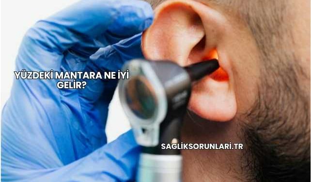 Yüzdeki Mantara Ne İyi Gelir?