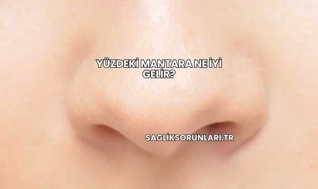 Yüzdeki Mantara Ne İyi Gelir?