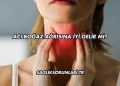 Acı Boğaz Ağrısına İyi Gelir mi?