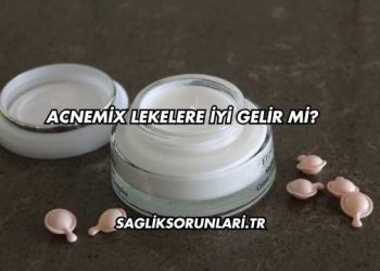 Acnemix Lekelere İyi Gelir mi?