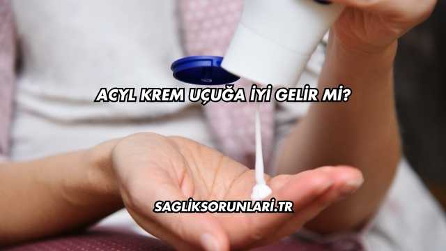 Acyl Krem Uçuğa İyi Gelir mi?
