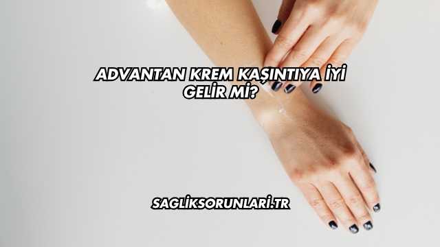 Advantan Krem Kaşıntıya İyi Gelir mi?