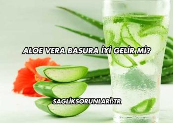 Aloe Vera Basura İyi Gelir mi?