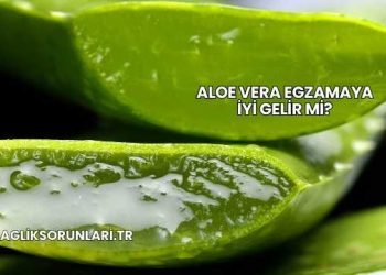 Aloe Vera Egzamaya İyi Gelir mi?