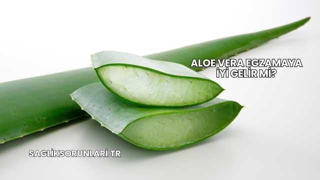 Aloe Vera Egzamaya İyi Gelir mi?