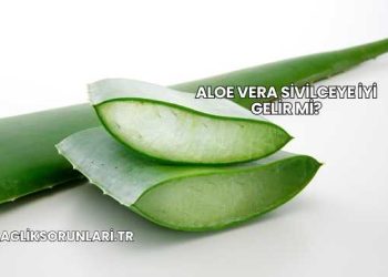 Aloe Vera Sivilceye İyi Gelir mi?