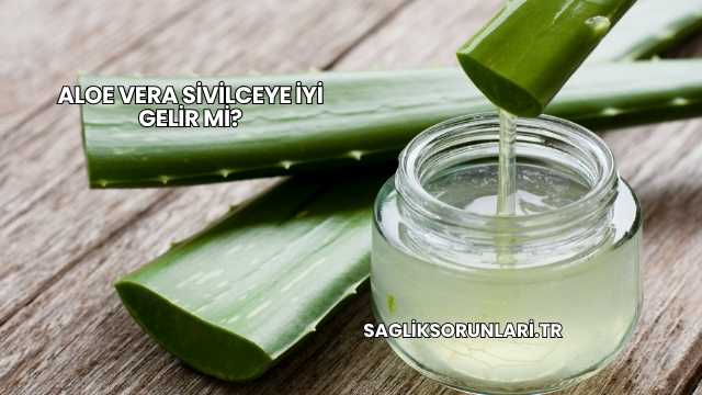 Aloe Vera Sivilceye İyi Gelir mi?
