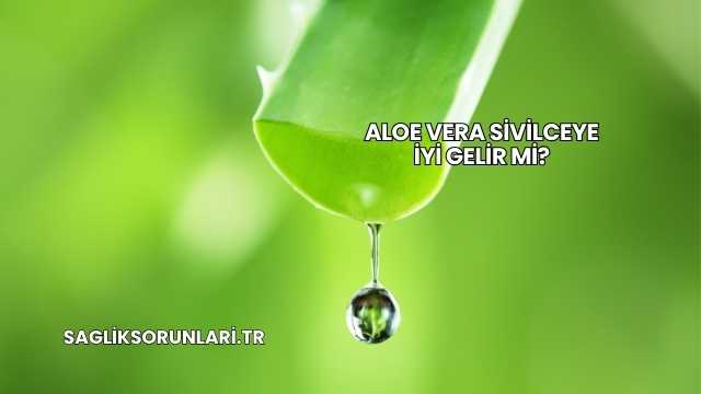 Aloe Vera Sivilceye İyi Gelir mi?