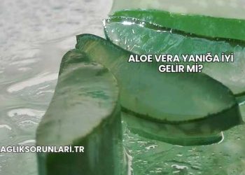 Aloe Vera Yanığa İyi Gelir mi?