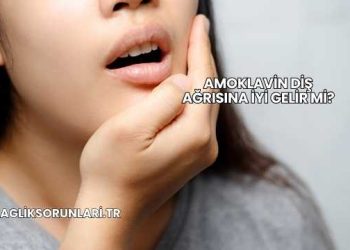 Amoklavin Diş Ağrısına İyi Gelir mi?