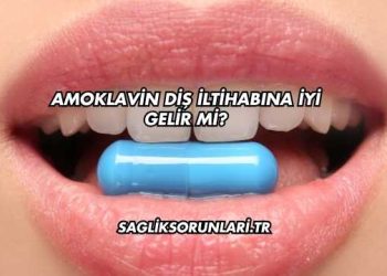 Amoklavin Diş İltihabına İyi Gelir mi?