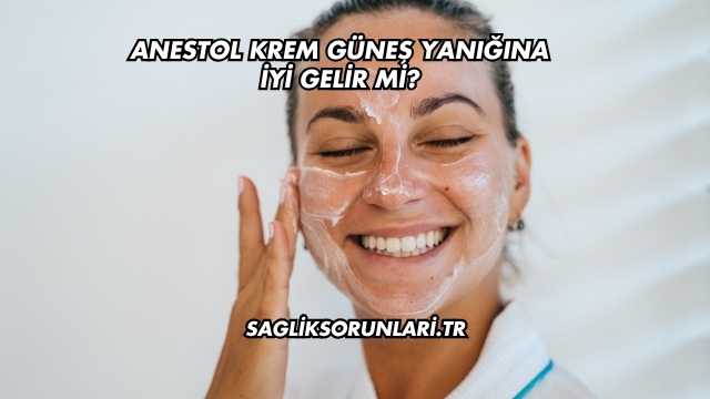Anestol Krem Güneş Yanığına İyi Gelir mi?