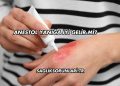 Anestol Yanığa İyi Gelir mi?
