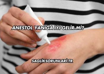 Anestol Yanığa İyi Gelir mi?