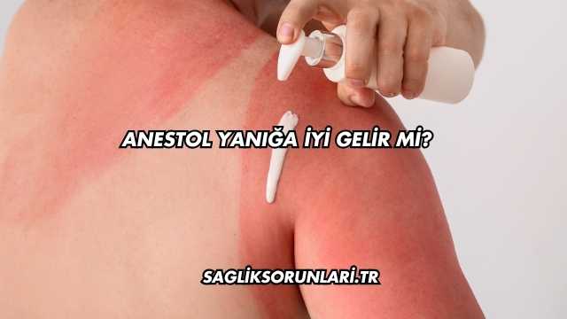 Anestol Yanığa İyi Gelir mi?