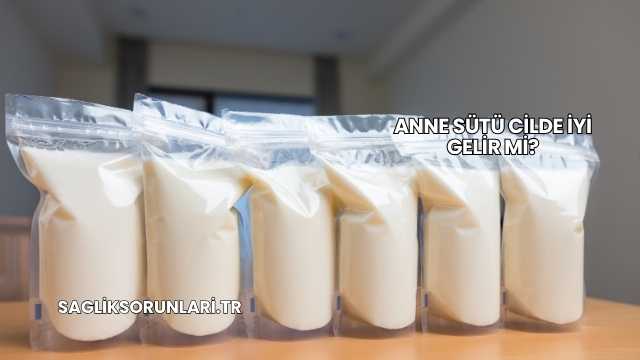 Anne Sütü Cilde İyi Gelir mi?