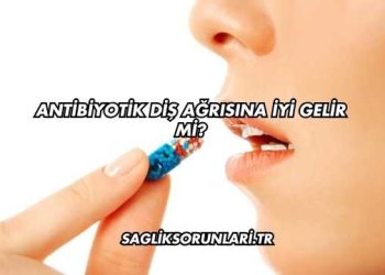 Antibiyotik Diş Ağrısına İyi Gelir mi?