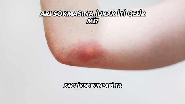 Arı Sokmasına İdrar İyi Gelir mi?