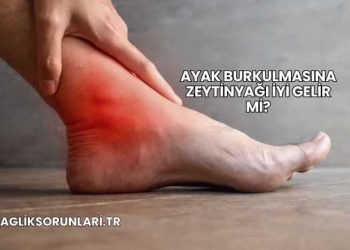 Ayak Burkulmasına Zeytinyağı İyi Gelir mi?