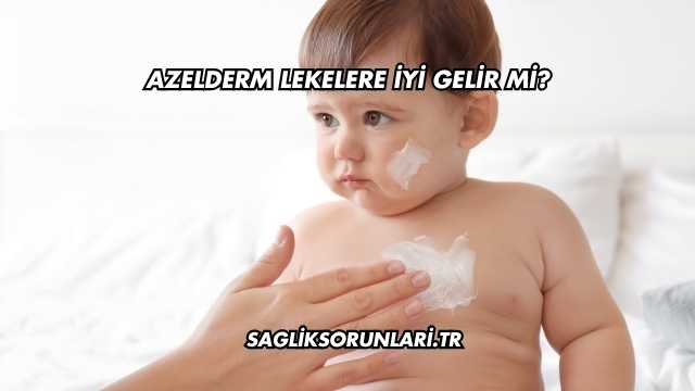 Azelderm Lekelere İyi Gelir mi?