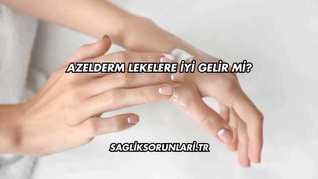 Azelderm Lekelere İyi Gelir mi?