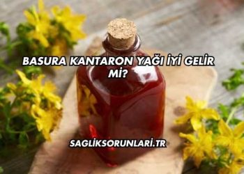 Basura Kantaron Yağı İyi Gelir mi?