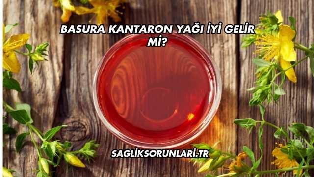 Basura Kantaron Yağı İyi Gelir mi?