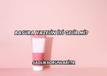 Basura Vazelin İyi Gelir mi?