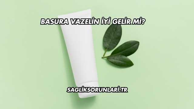 Basura Vazelin İyi Gelir mi?
