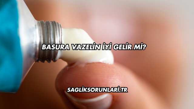 Basura Vazelin İyi Gelir mi?