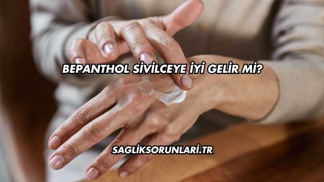 Bepanthol Sivilceye İyi Gelir mi?