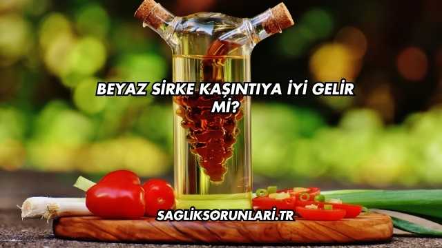 Beyaz Sirke Kaşıntıya İyi Gelir mi?