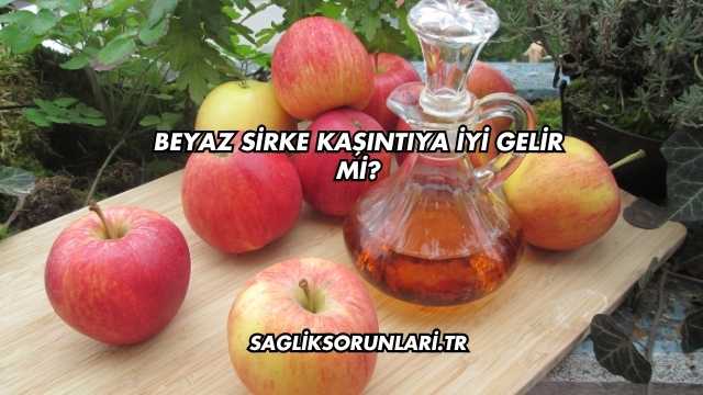 Beyaz Sirke Kaşıntıya İyi Gelir mi?